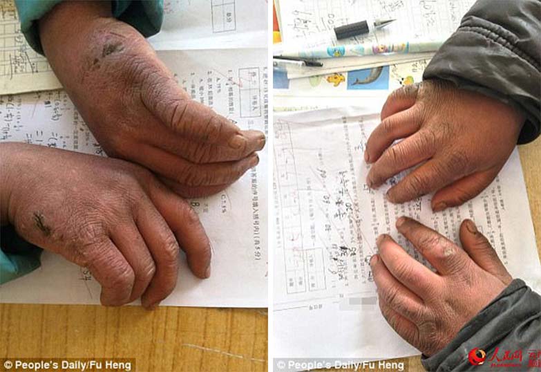 &Kappa;&Iota;&Nu;&Alpha; &Mu;&Iota;&Kappa;&Rho;&Omicron;&Sigma;