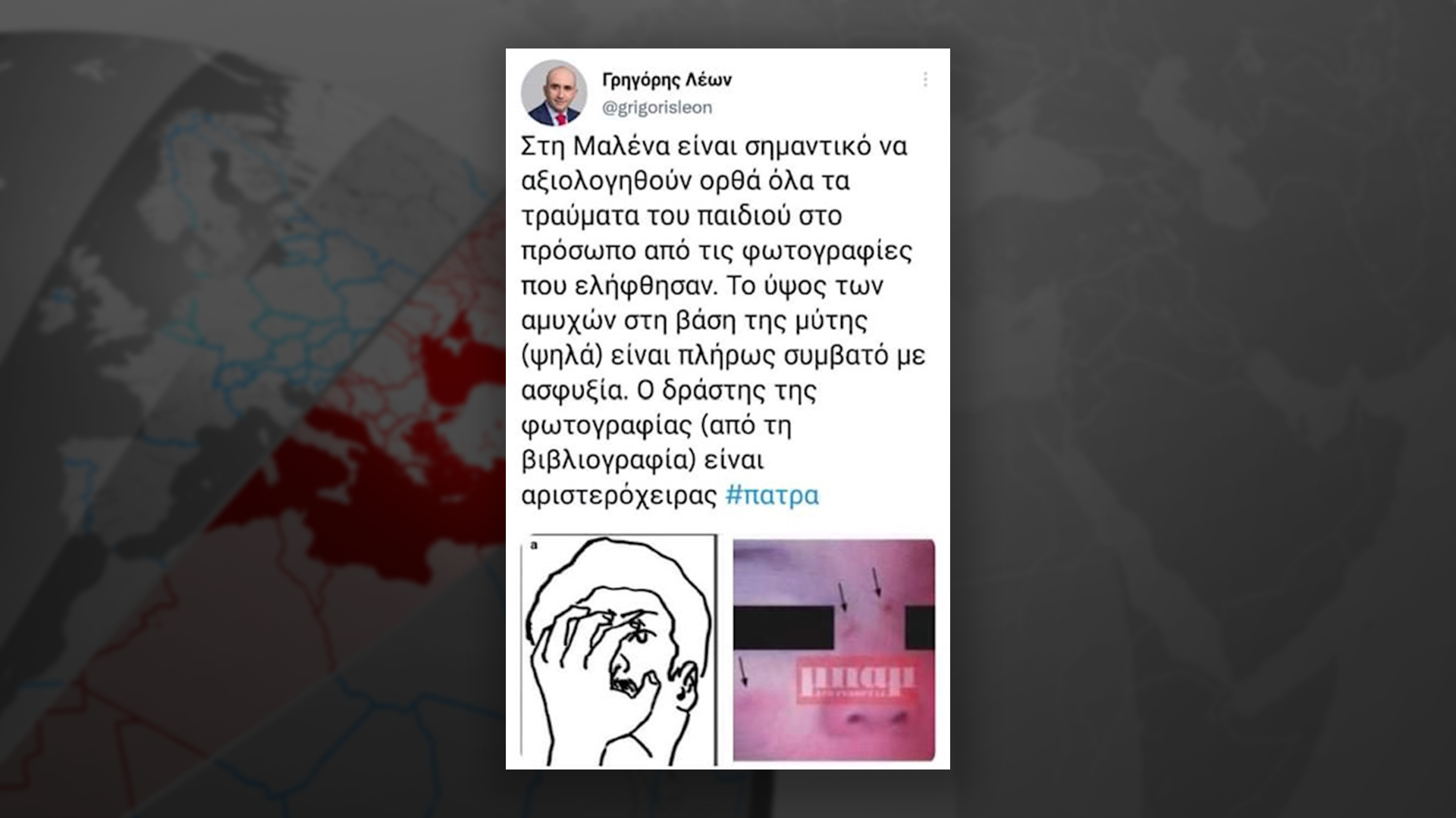 ΜΑΛΕΝΑ ΤΡΑΥΜΑΤΑ